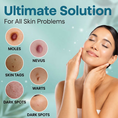 Mole & Wart Removal Laser Pen